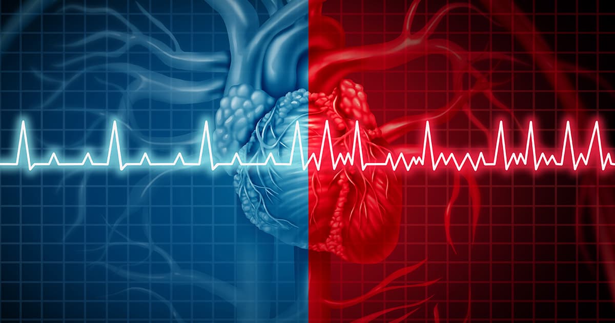 Les maladies cardiovasculaires