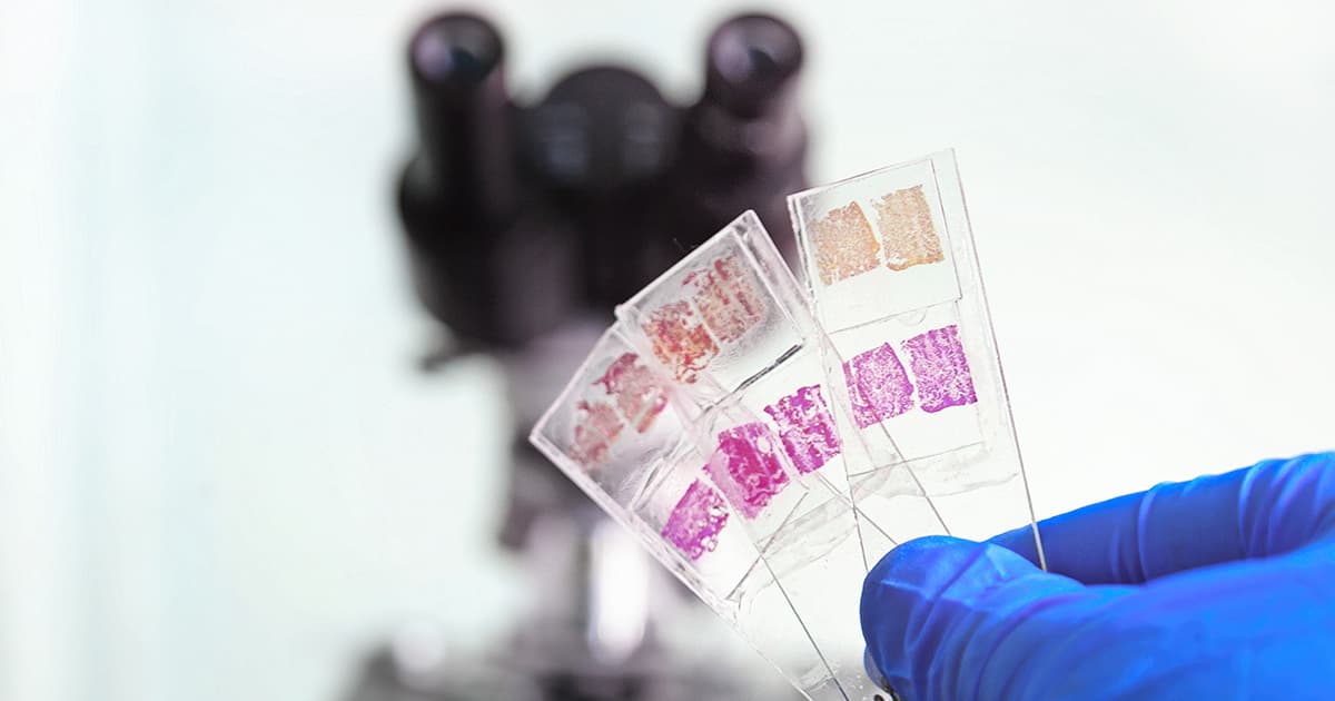 Les types de biopsies